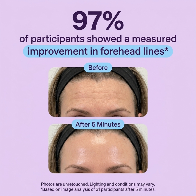LumiLift™ - eye gel