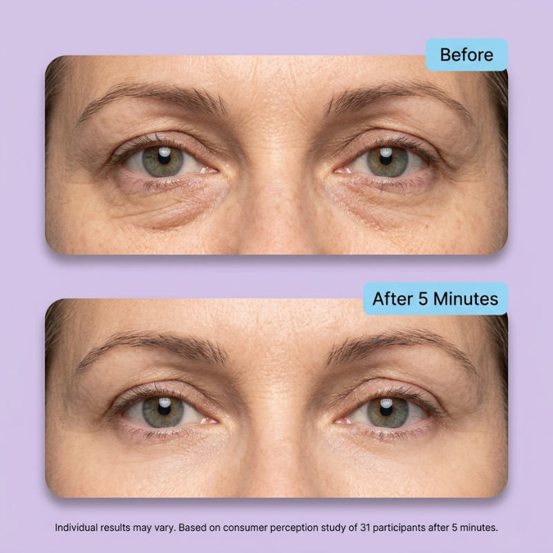 LumiLift™ - eye gel