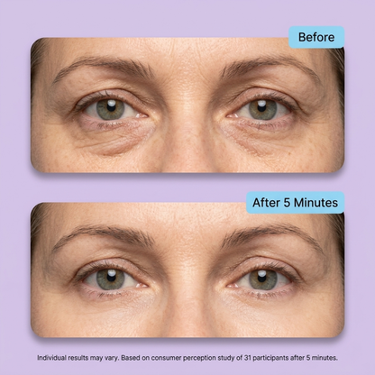 LumiLift™ - eye gel